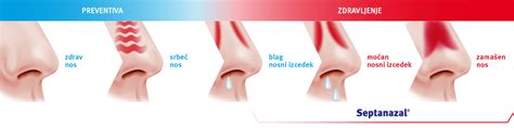 Diagram barv izcedka iz nosu