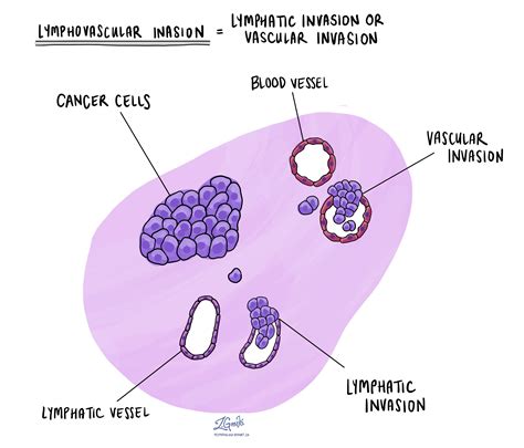 Ilustracija celic materničnega vratu pod mikroskopom