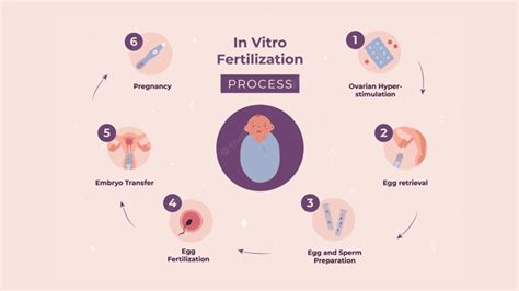 Diagram postopka zunajtelesne oploditve (IVF)