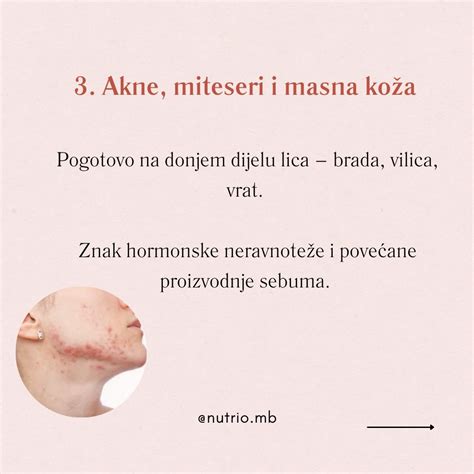 Nosečniška koža in spremembe