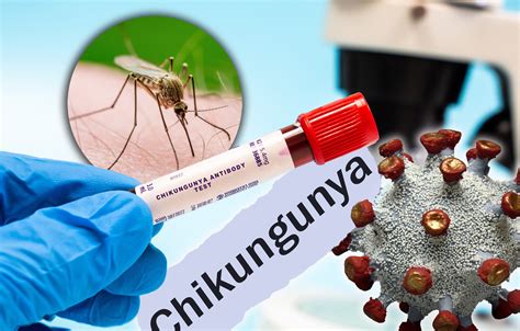 Ilustracija virusa čikungunja