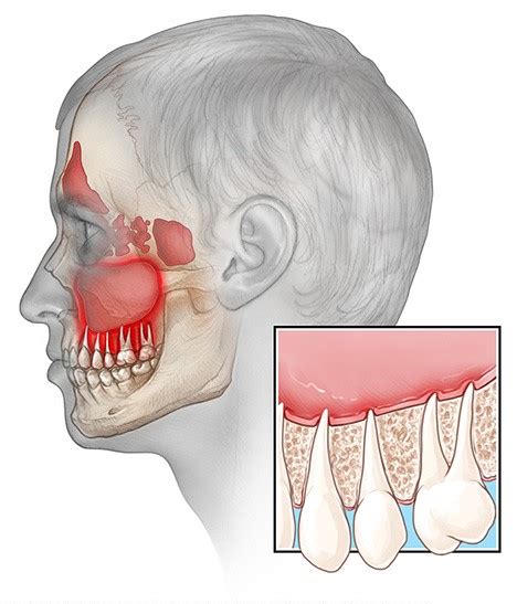 Ilustracija otroka, ki se drži za boleč zob