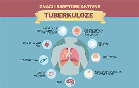 Diagram prenosa tuberkuloze s kapljičnim načinom