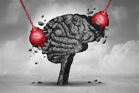 Diagram, ki prikazuje možganske poškodbe zaradi stresanja dojenčka