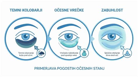 ilustracija ženske s temnimi kolobarji pod očmi