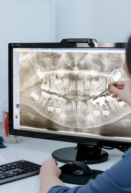 Rentgenski posnetek zob otroka