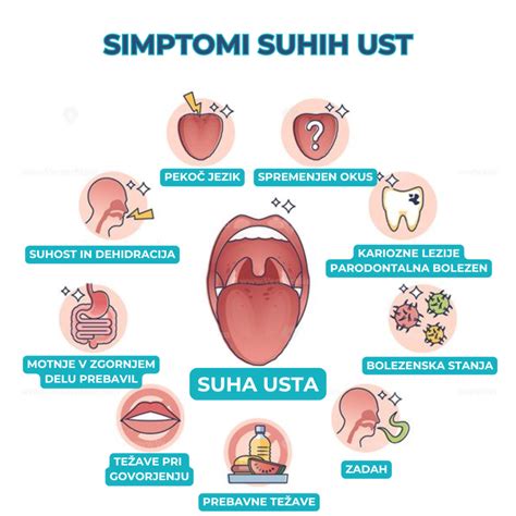 Infografika, ki prikazuje pogoste vzroke za suha usta v nosečnosti