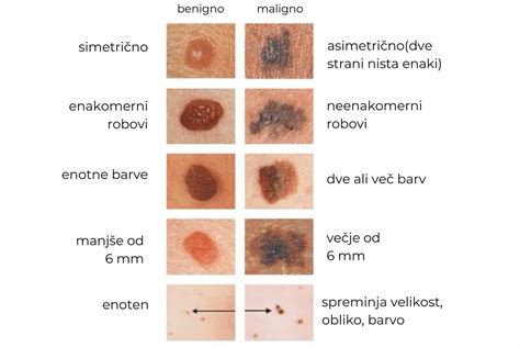 simbolična upodobitev nosečnice in znamenj na otrokovem telesu