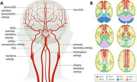 Shematski prikaz preloma lobanje, ki povzroči poškodbo srednje možganske arterije in epiduralno krvavitev