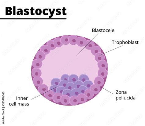 Diagram ugnezditve blastociste v maternico