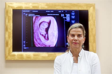 Grafikon, ki prikazuje upad plodnosti žensk z starostjo.