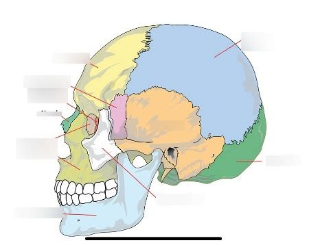 Diagram lobanje z označenima plagiocefalijo in brahiocefalijo
