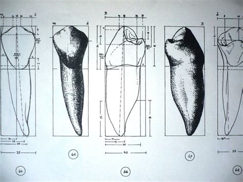 Diagram človeškega zobovja