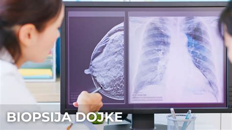 Diagram, ki prikazuje proces biopsije dojke.