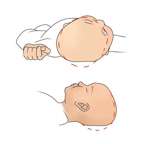 Diagram prikazuje pritiske na glavo dojenčka med porodom