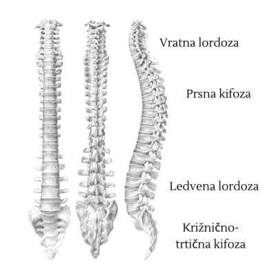 Diagram, ki prikazuje razliko med epiduralnim in spinalnim prostorom v hrbtenici.
