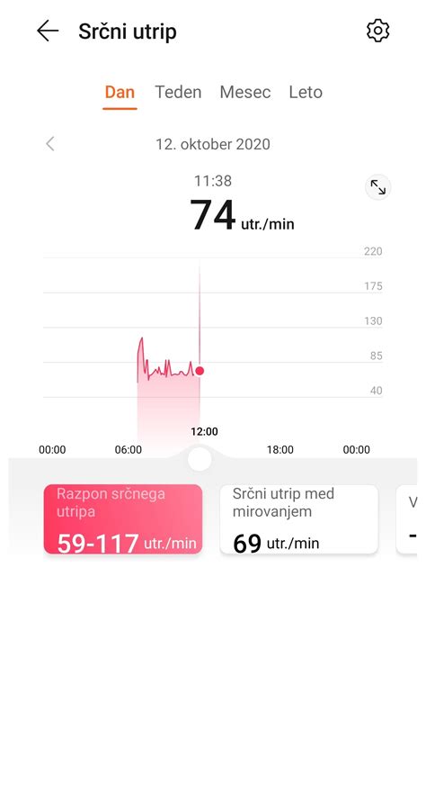 Graf srčnega utripa med nosečnostjo