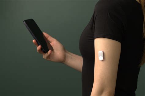 naprava za neprekinjeno merjenje glukoze (CGM)