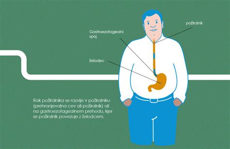 Prikaz anatomije požiralnika in želodca z označeno mišično zapiralko.