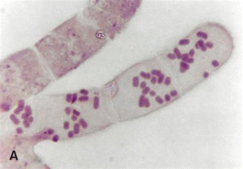 Mikroskopski posnetek Candide albicans