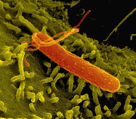 Mikroskopski posnetek bakterije Helicobacter pylori