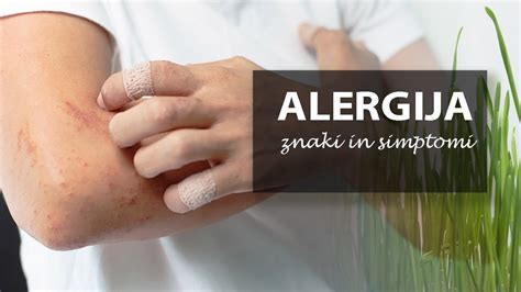 Ilustracija pika komarja na otroški koži