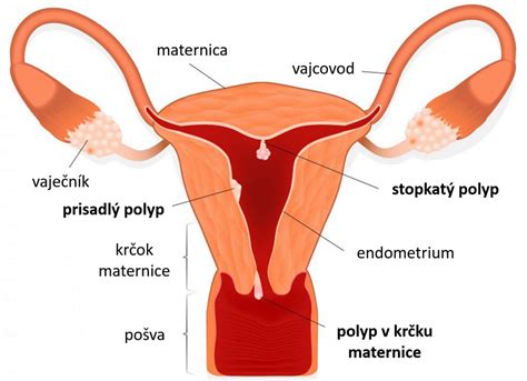 Diagram ženskega reproduktivnega sistema s poudarkom na jajčnikih, jajcevodih in maternici.