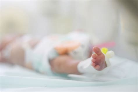 Novorojenček s fiziološkimi kožnimi spremembami