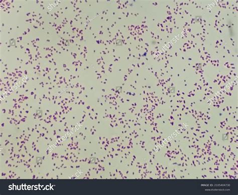 mikroskopski prikaz bakterij Gardnerella vaginalis