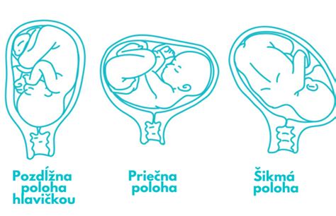 Diagram prikazuje lokacijo ugnezditve zarodka v maternici in jajcevodih