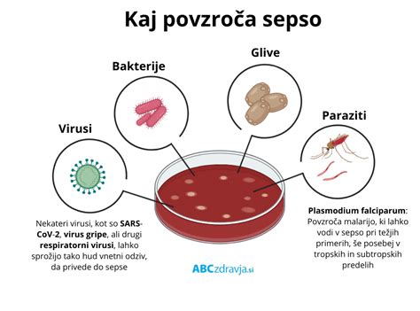 Grafika, ki prikazuje bakterije, ki povzročajo okužbo sečil