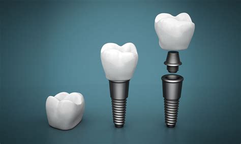 Ilustracija nosečnice, ki skrbi za svoje zobe
