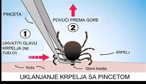Fotografija štorkljinega ugriza na otrokovem tilniku