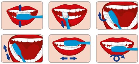 Ilustracija pravilne tehnike ščetkanja zob