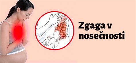 Ilustracija ženske, ki doživlja zgago med nosečnostjo