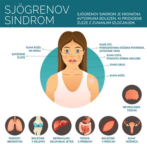 Prikaz sindroma razširjenih venskih pletežev v medenici