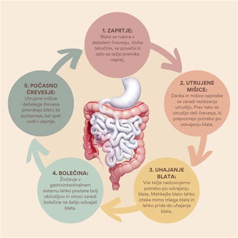 Infografika, ki prikazuje različne funkcionalne vzroke zaprtja pri otrocih.