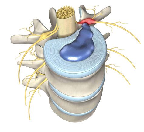 Diagram hrbtenice z območjem spinalne anestezije