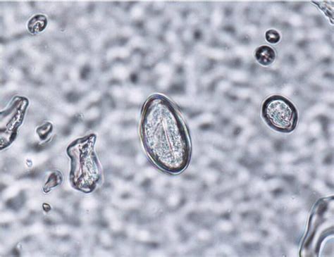 mikroskopsko sliko oplojenega jajčeca