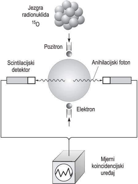 Shema nastanka potničk zaradi zamašenih znojnic