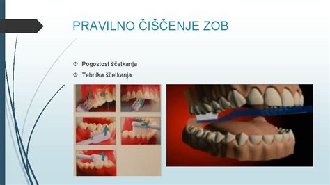 diagram pravilnega ščetkanja zob
