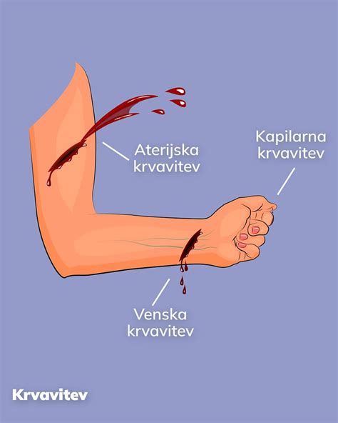 Infografika, ki primerja vgnezditveno krvavitev in menstruacijo