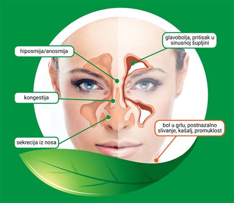 Ilustracija človeške nosne votline s poudarkom na vnetih tkivih in nabiranju sluzi