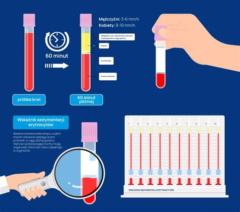 Infografika: Navodila ob pozabljeni kontracepcijski tabletki