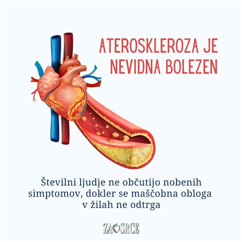 Diagram, ki prikazuje potek vazospazma v krvni žili bradavice.