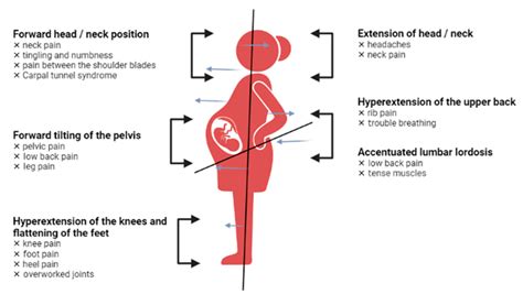 diagram pravilne drže med nosečnostjo