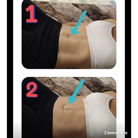 Ilustracija samopreverjanja diastaze