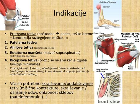 Diagram ženskega telesa po porodu s poudarkom na trebušnih mišicah