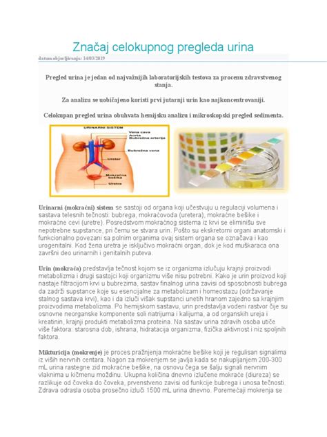 Diagram rutinskega pregleda urina