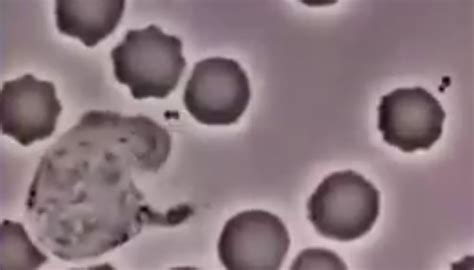 mikroskopski prikaz semenčic